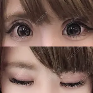before image