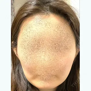before image