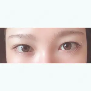 before image
