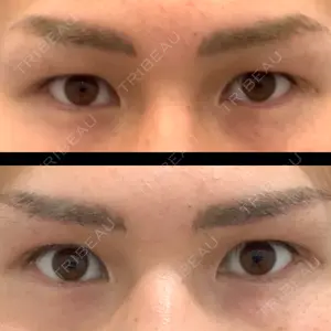 before image