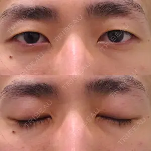 before image