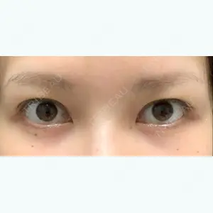 before image