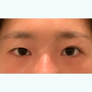高須クリニック 横浜院口コミ