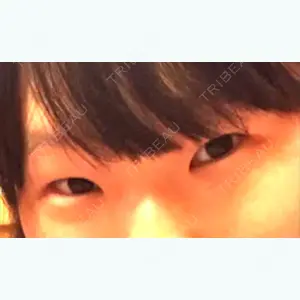 before image