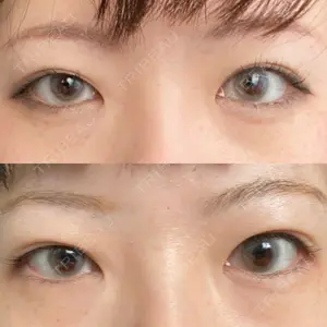 before image