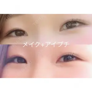 before image
