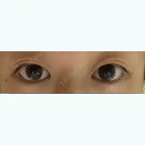 before image