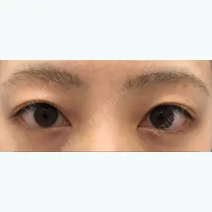 before image
