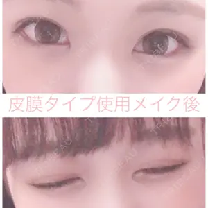 湘南美容クリニック 湘南美容クリニック赤坂見附院口コミ