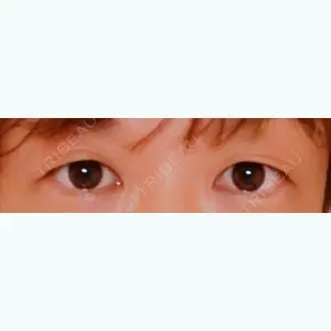 before image