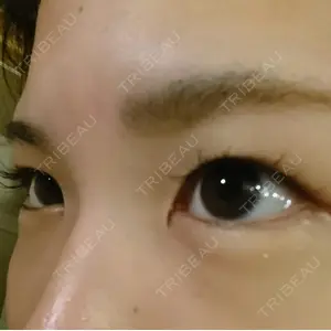 before image
