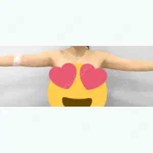 ヨンセスリムライン口コミ