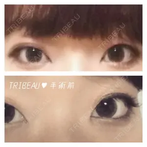before image