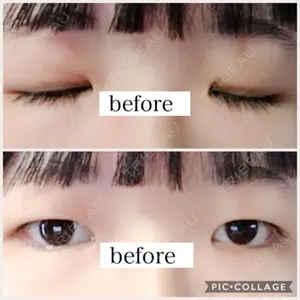 before image