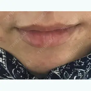 口コミ