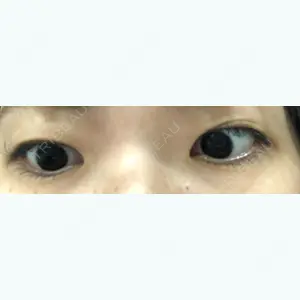 東京形成美容外科の口コミ