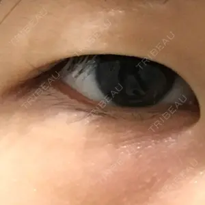 before image