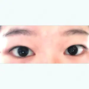 before image