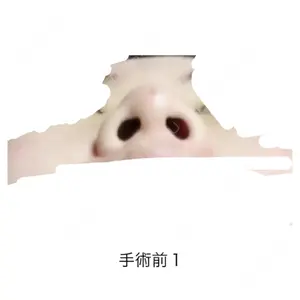 HANABI整形外科口コミ