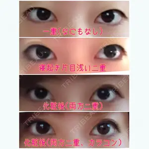 before image