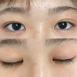 before image