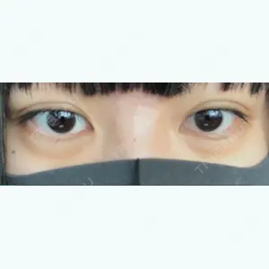 東京美容外科 東京美容外科 梅田院口コミ
