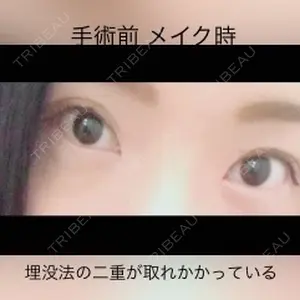 before image