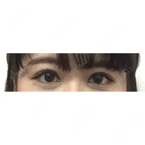 湘南美容クリニック 湘南美容クリニック赤坂見附院口コミ