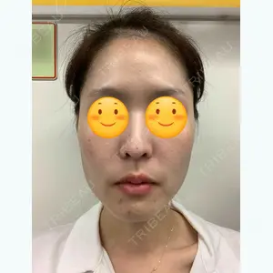 DA美容外科のLEE DONG CHAN医師口コミ