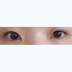 釜山フォーシーズン美容外科口コミ