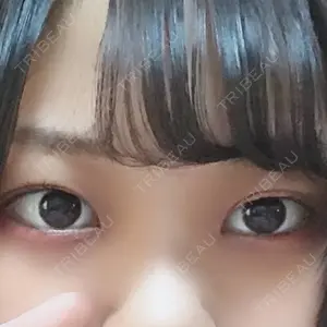 品川美容外科品川院の秦 真治医師口コミ