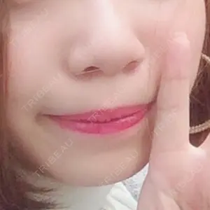 口コミ