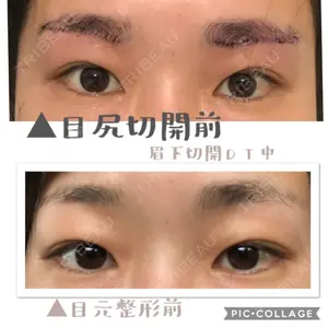 before image