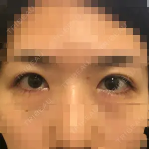 before image