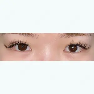 あつぎ美容クリニック口コミ