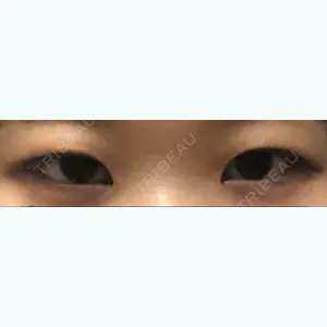 before image