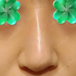 B-LINE CLINIC 池袋院の小池 康弘医師口コミ