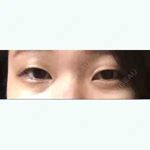 マーブル整形外科のイ・ジュンヒ医師口コミ