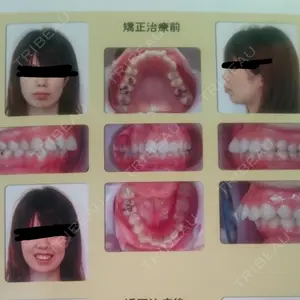 before image