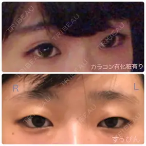 before image
