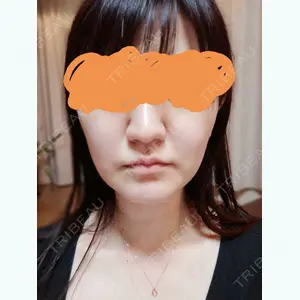 湘南美容クリニック 湘南美容クリニック 熊本院口コミ