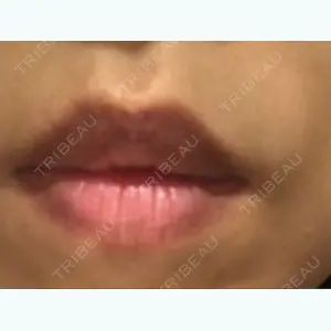 before image