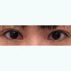 before image