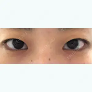 before image