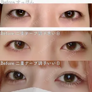 東京形成美容外科の口コミ