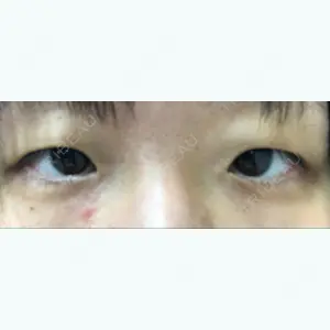 before image