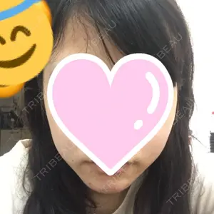 before image