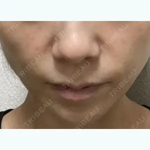 二子玉川美容外科クリニック口コミ