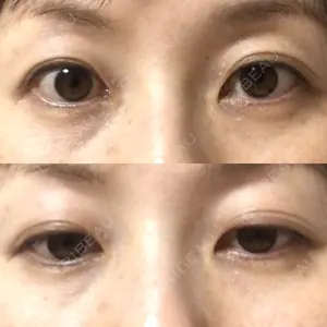 before image