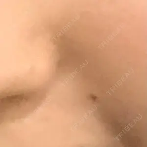 大山皮膚科口コミ